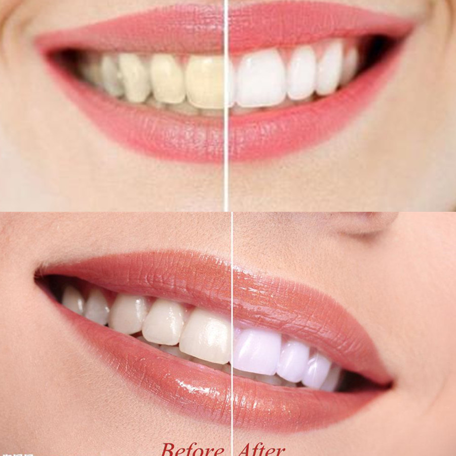 Bamboo Charcoal Teeth Tooth De - Teeth Whitening Levels avis et prix