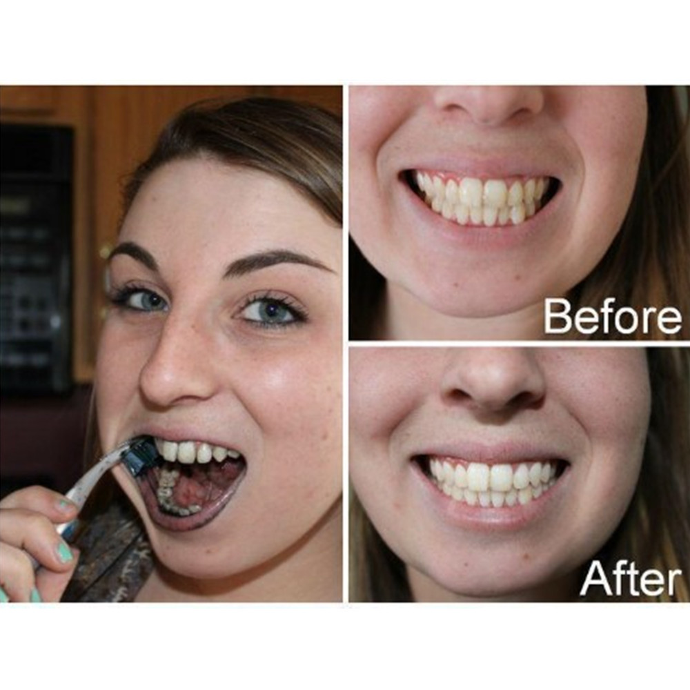 Bamboo Charcoal Teeth Tooth De - Teeth Whitening Levels avis et prix