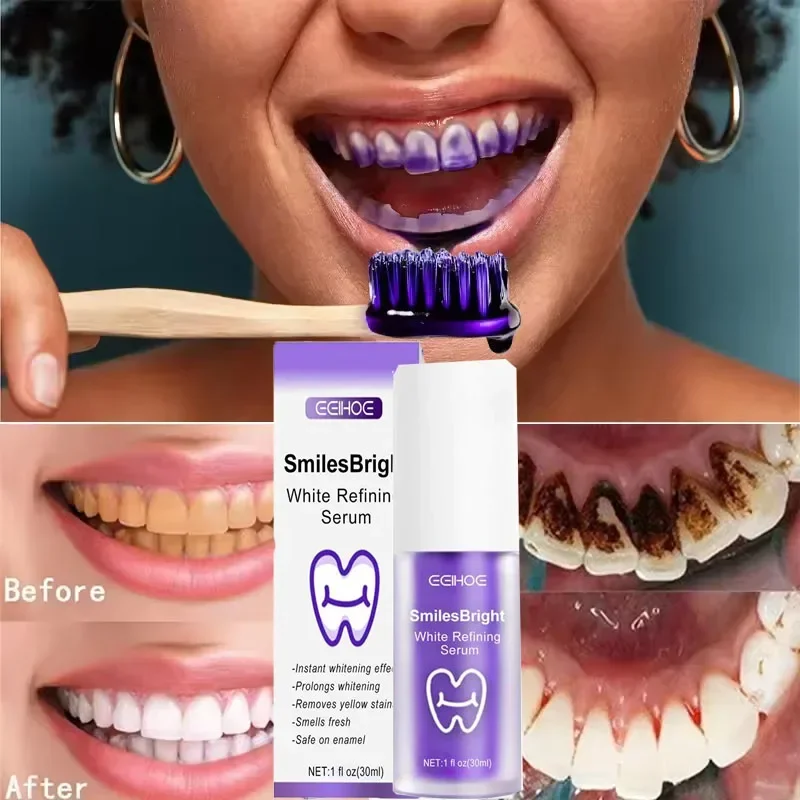 Teeth Cleansing Whitening Toot - Teeth Whitening In Korea avis et prix