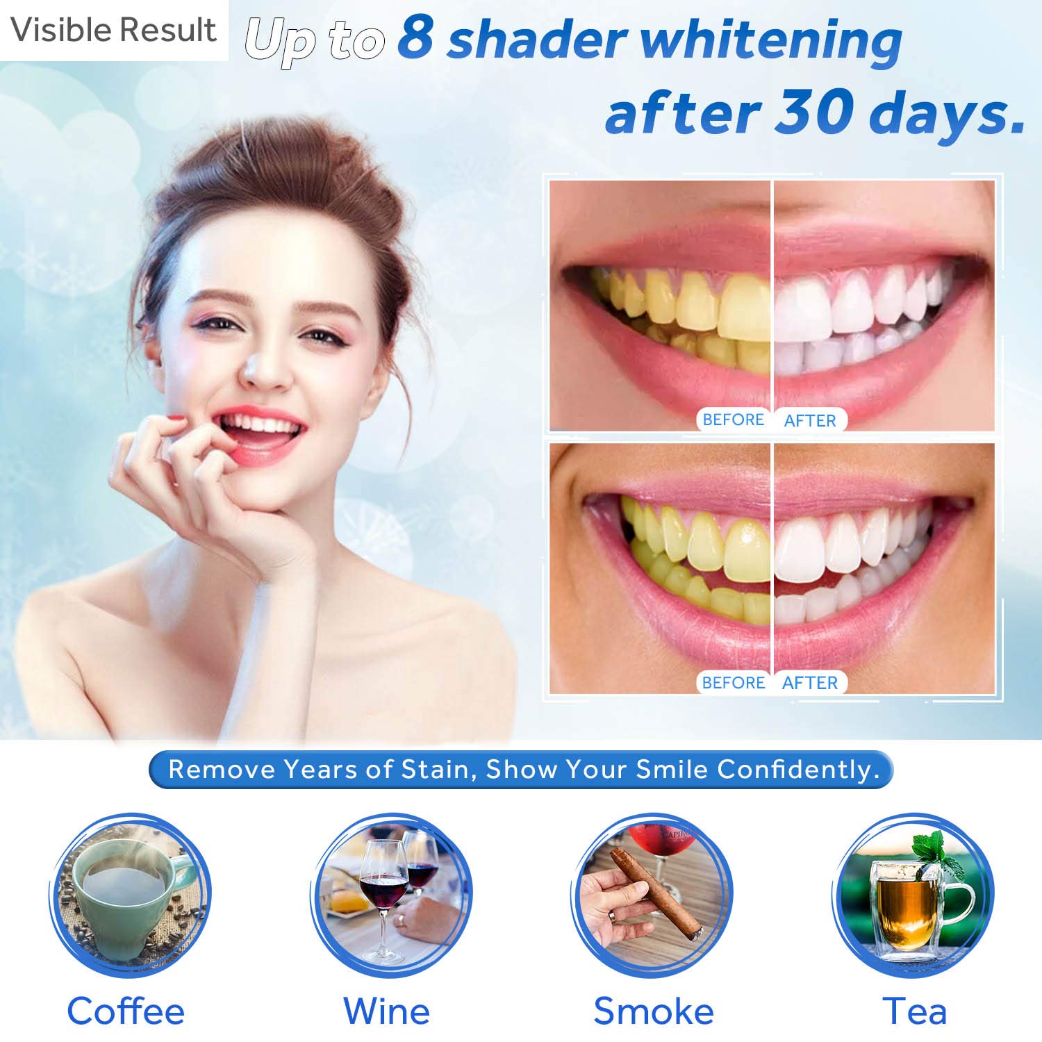 Teeth Whitening Gel Refill Syr - Teeth Whitening Price avis et prix
