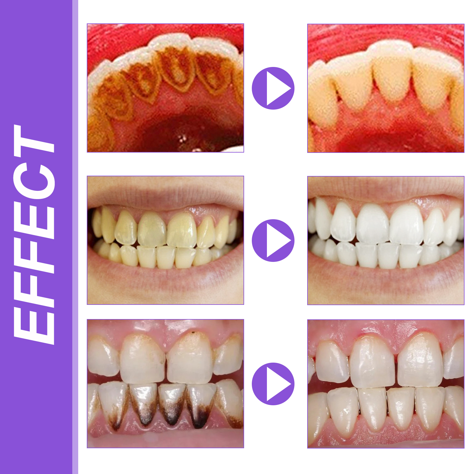 EELHOE Smiles Bright White Ref - Teeth Whitening Ingredients avis et prix