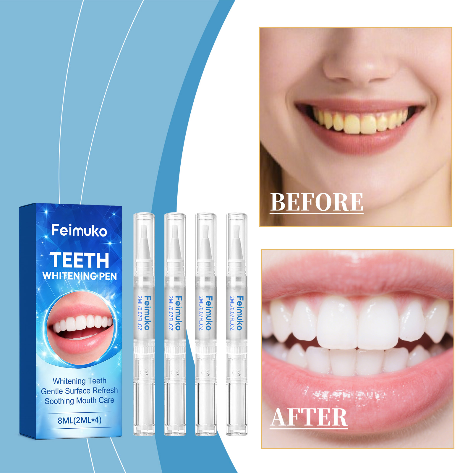 Feimuko 8ml Teeth Gel Pen Gent - Teeth Whitening Levels avis et prix