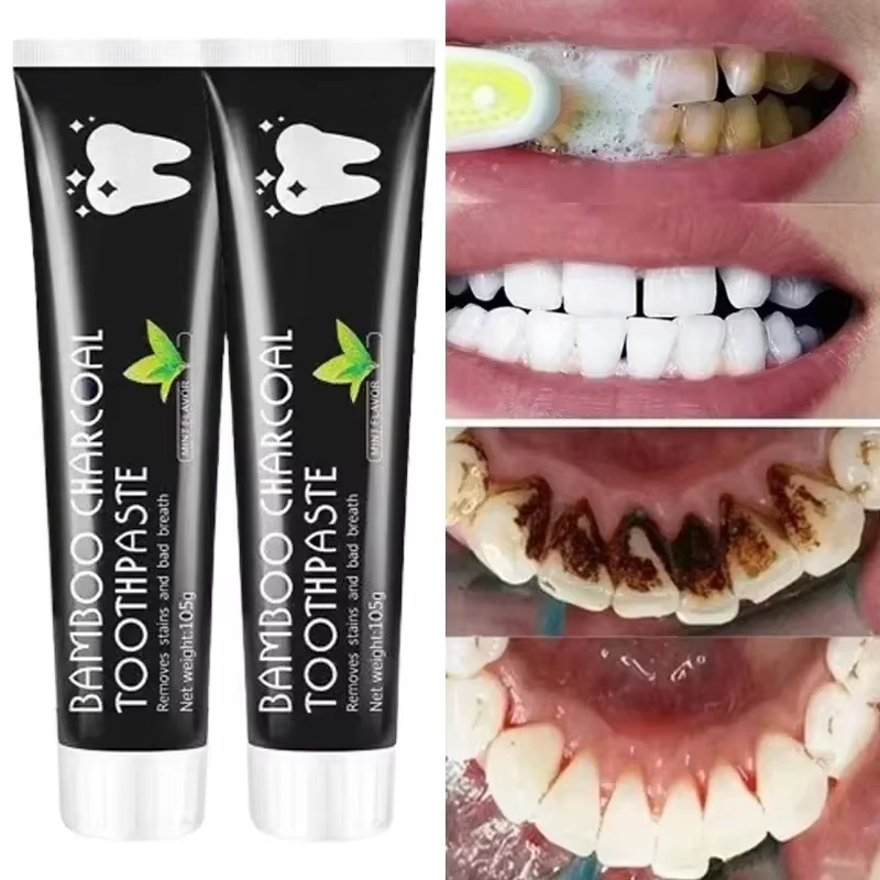 Whitening Toothpaste Bamboo Ch - Teeth Whitening Levels avis et prix