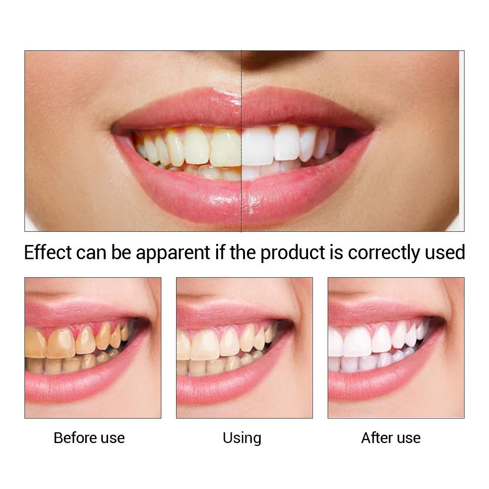 FTEENPLY Teeth Whitening Essen - Teeth Whitening Paste avis et prix