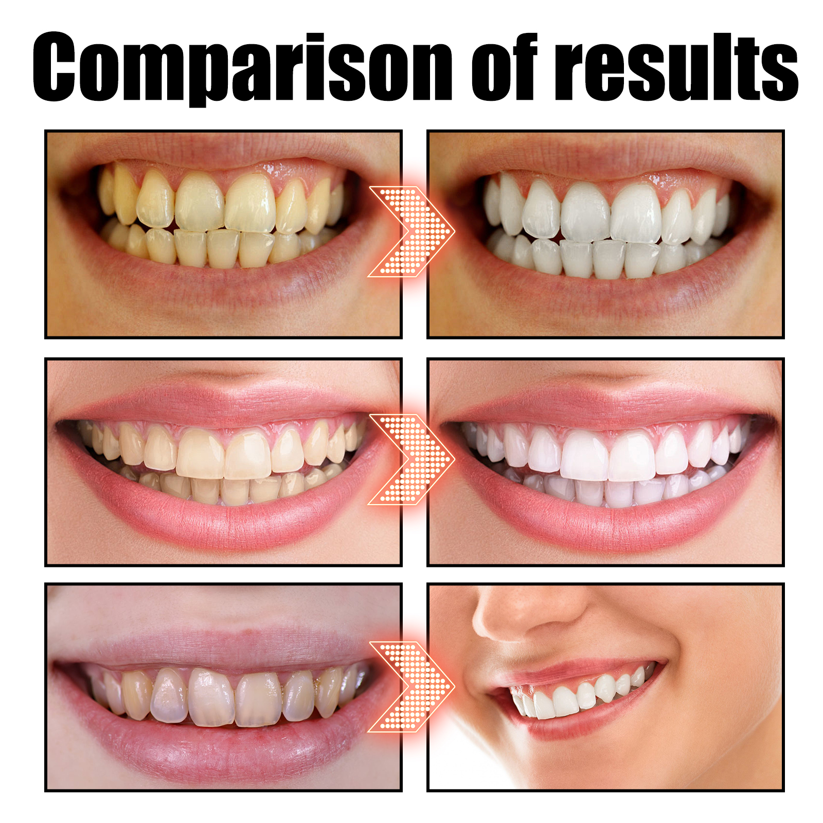 Coconut Oil Mouthwash Whitenin - Teeth Whitening Natural avis et prix