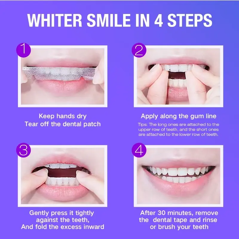 Teeth Whitening Kit - 5X LED L - Teeth Whitening Levels avis et prix