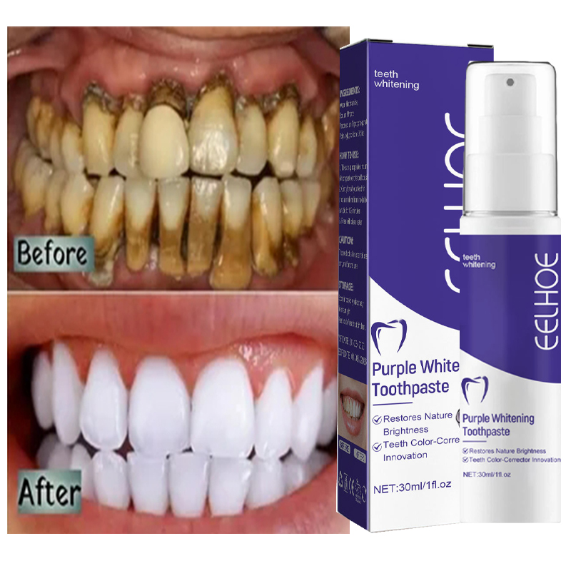 1pcs Teeth Cleansing Whitening - Teeth Whitening In Korea avis et prix