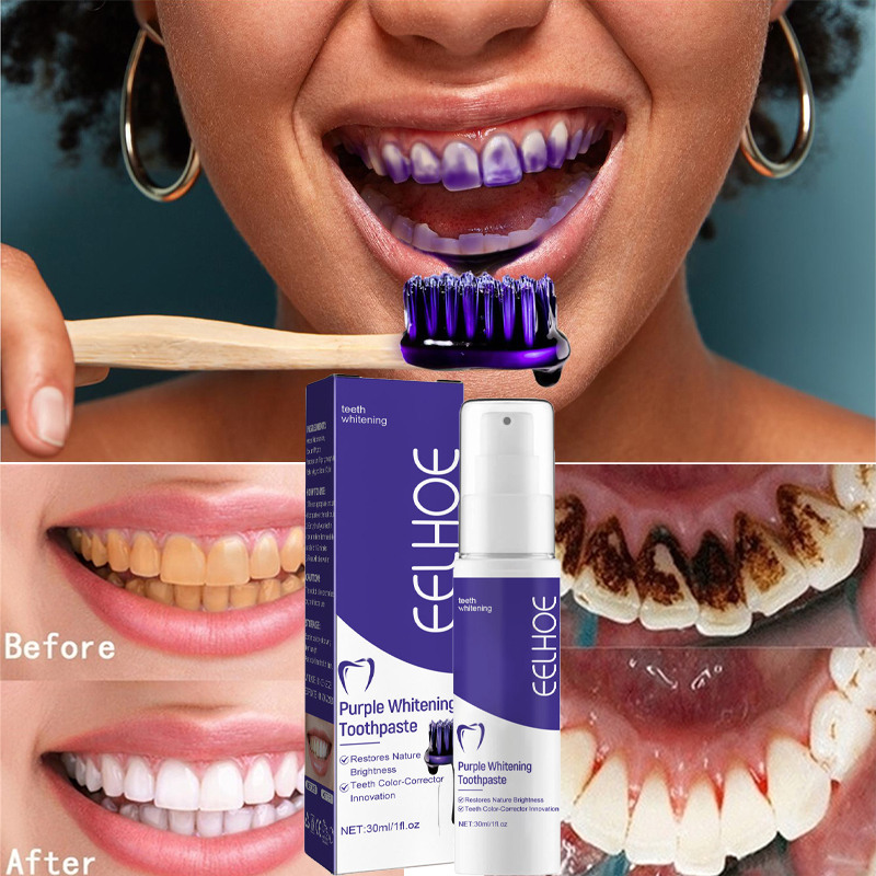 1pcs Teeth Cleansing Whitening - Teeth Whitening In Korea avis et prix