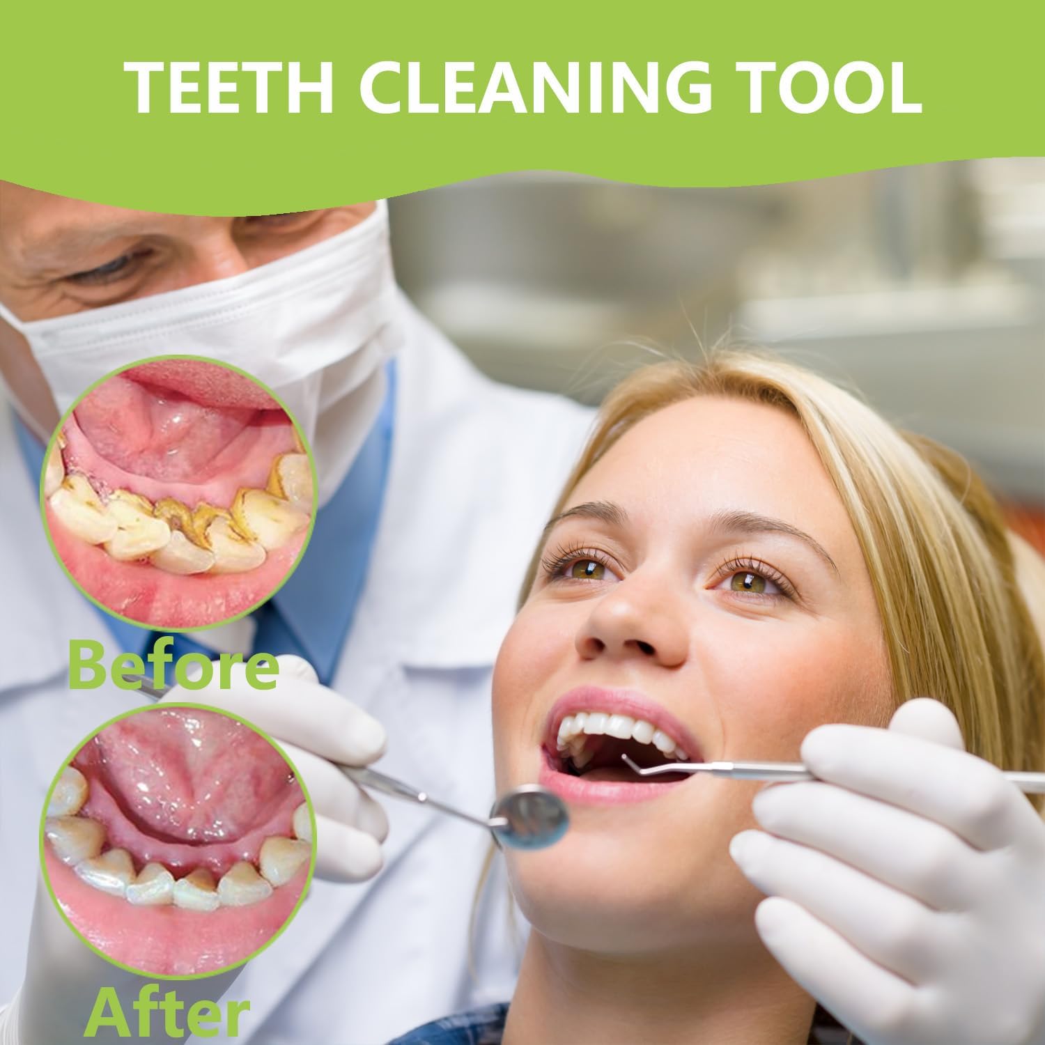 Professional Teeth Cleaning Or - Teeth Whitening Mouthwash avis et prix
