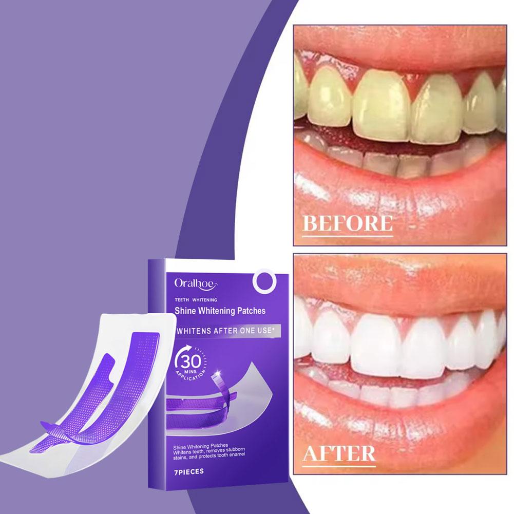 Purple Teeth Whitening Strips  - Teeth Whitening Flash avis et prix