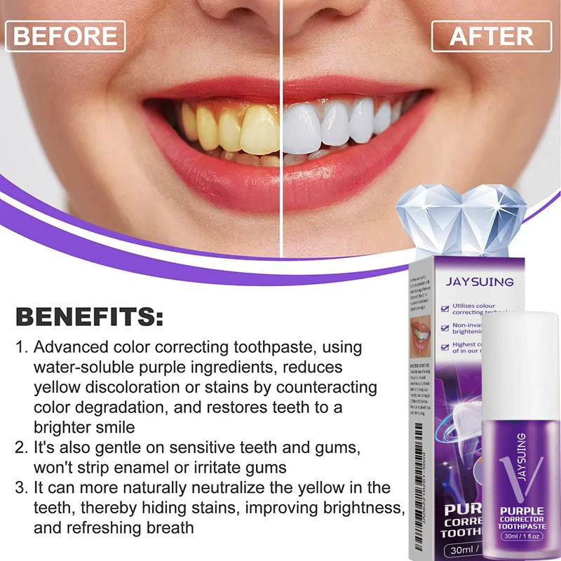 Teeth Cleansing Whitening Toot - Teeth Whitening In Korea avis et prix