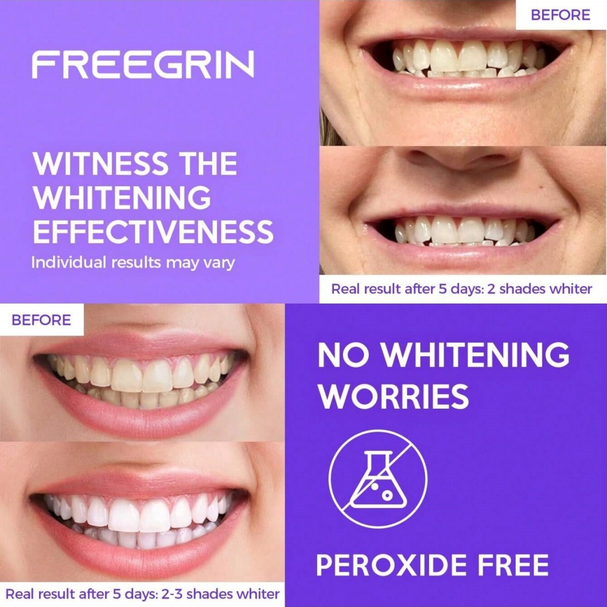 Deluxe Whitening Teeth Sticker - Teeth Whitening Levels avis et prix