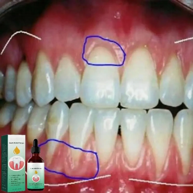 Gum Repair Drops Relieve Reced - Teeth Whitening Paste avis et prix