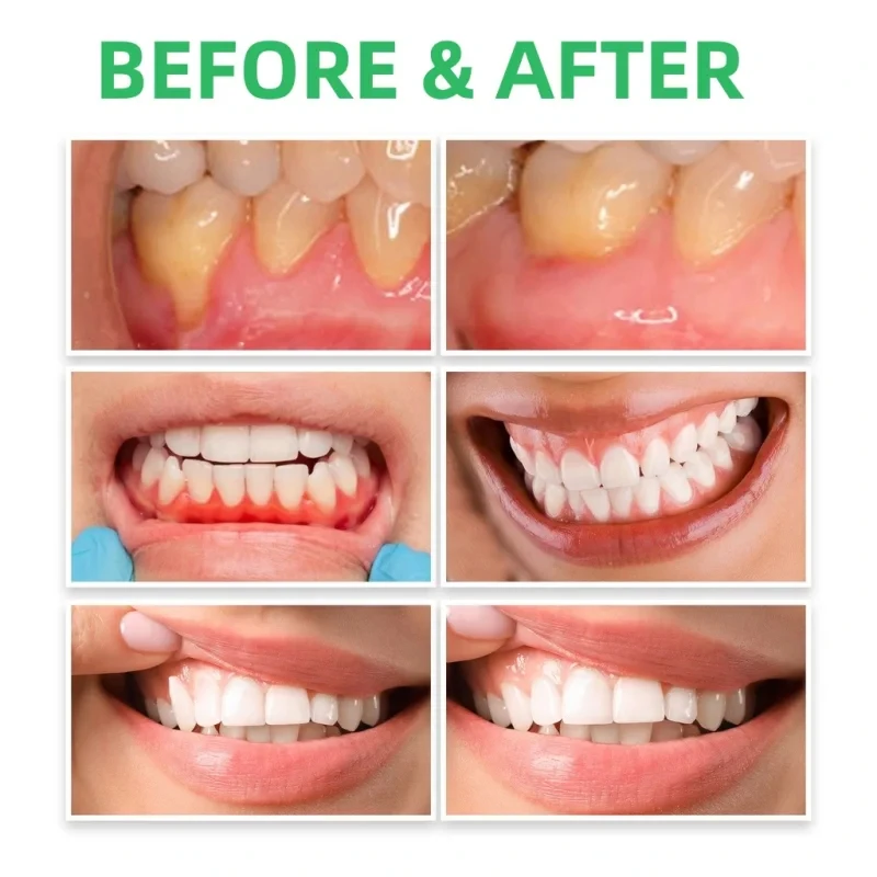 Gum Repair Drops Relieve Reced - Teeth Whitening Paste avis et prix
