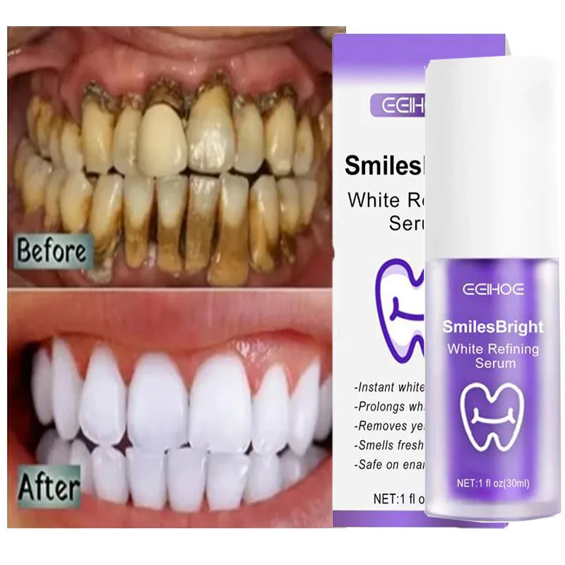 Whitening Toothpaste Teeth Cle - Teeth Whitening In Korea avis et prix