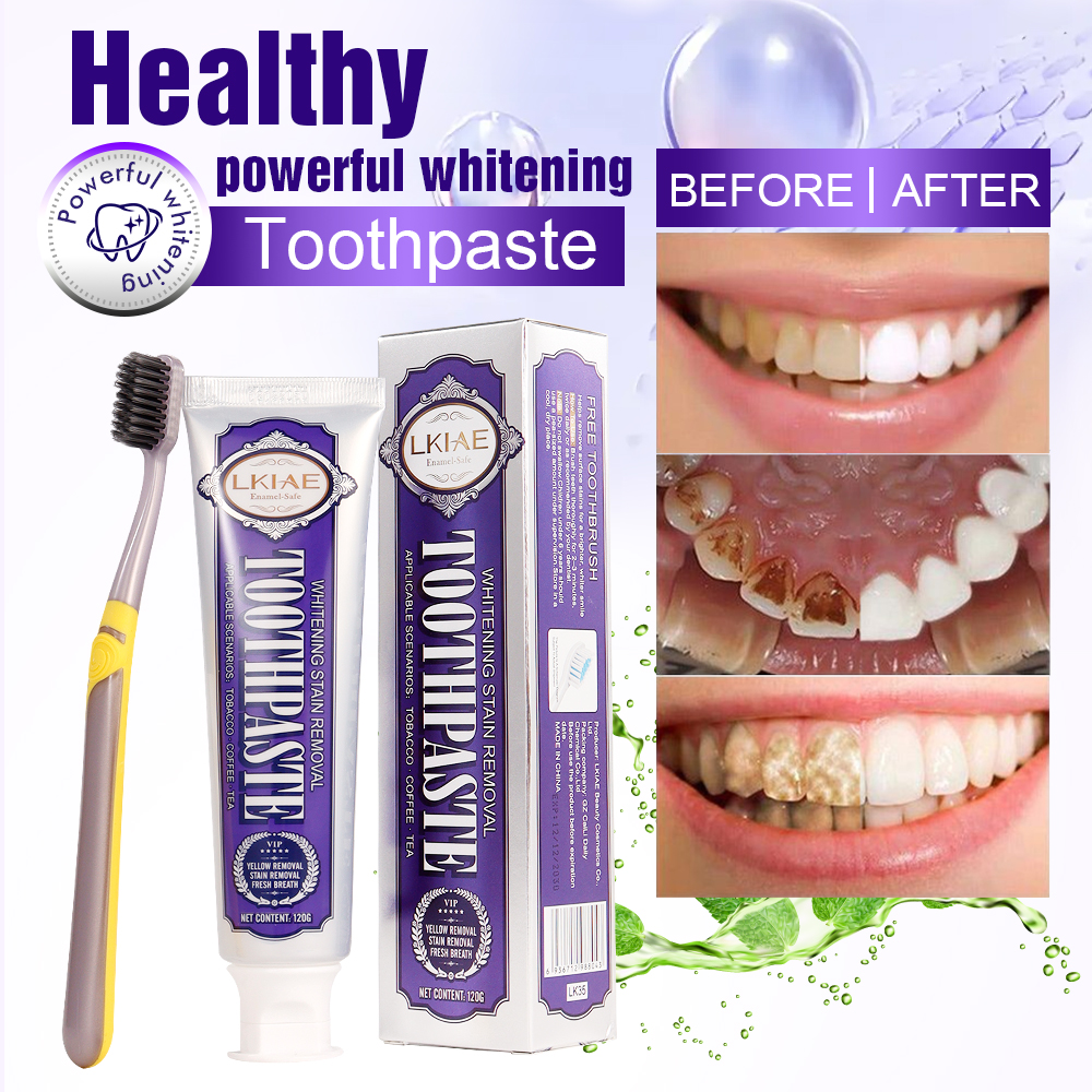LKIAE White Teeth Whitening To - Teeth Whitening Natural avis et prix