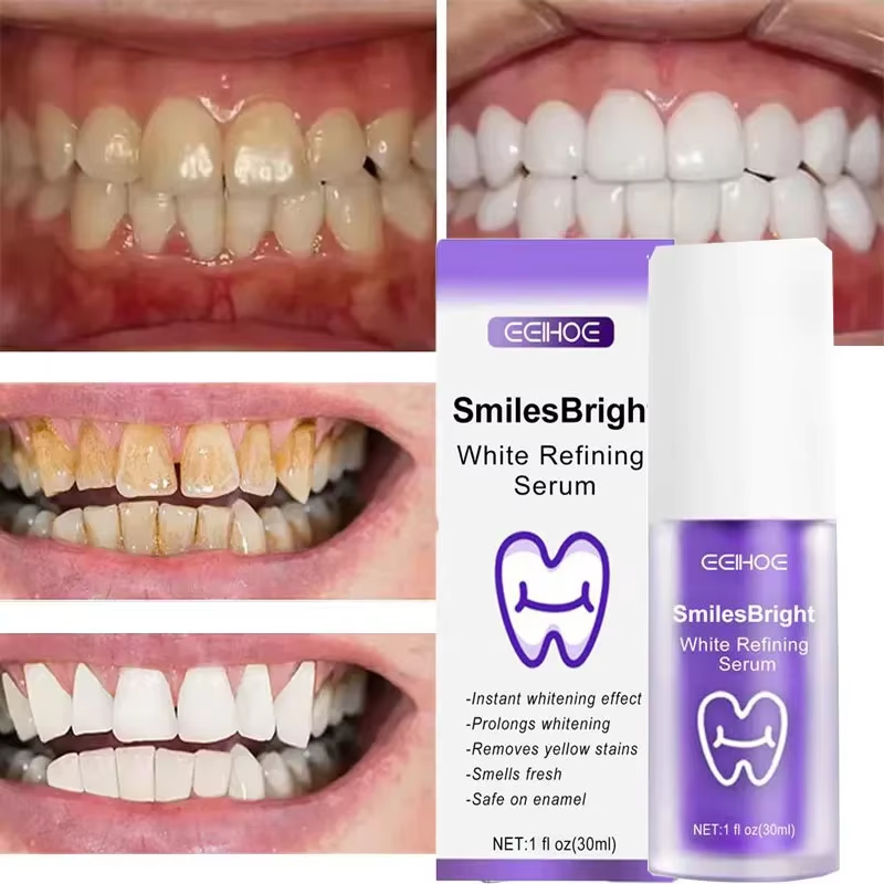 Teeth Cleansing Whitening Toot - Teeth Whitening In Korea avis et prix