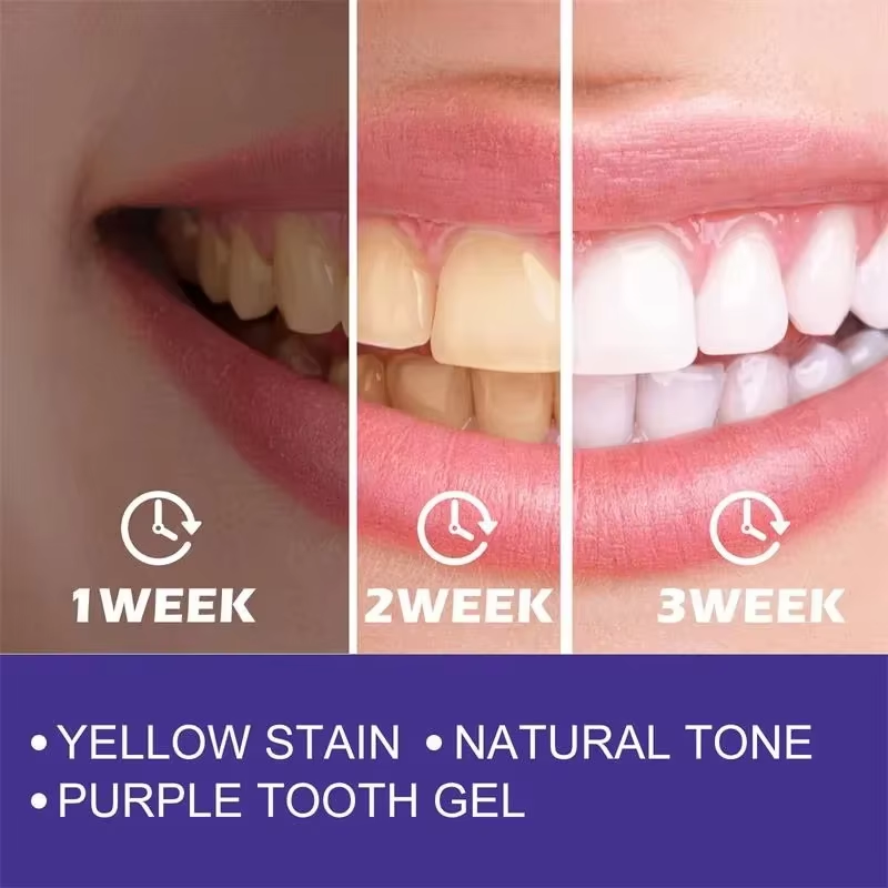 Teeth Cleansing Whitening Toot - Teeth Whitening In Korea avis et prix