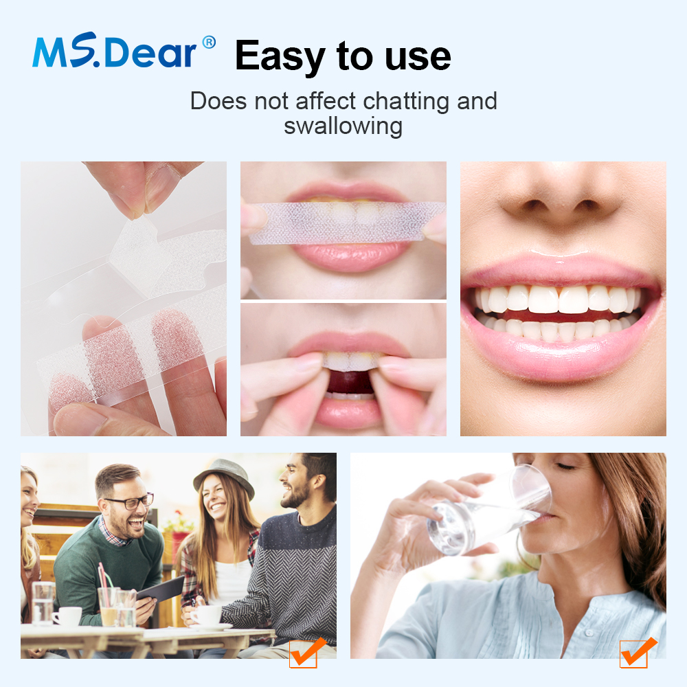 Teeth Whitening Strips Cleansi - Teeth Whitening Price avis et prix